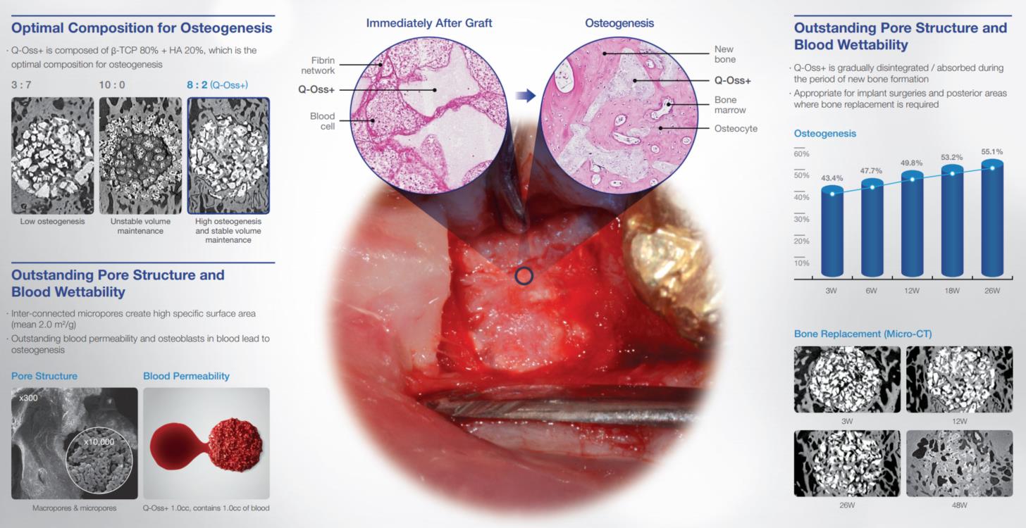 Q-Oss+-SyntheticBone.JPG