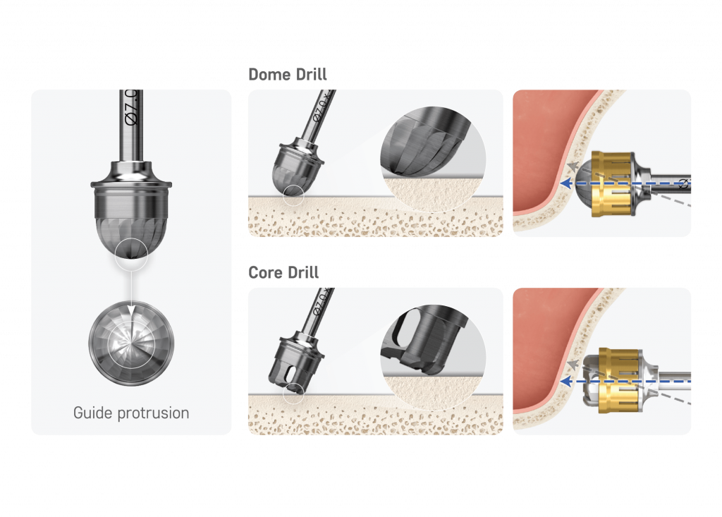 stable-drilling-perfromance-lateral-surgery.png
